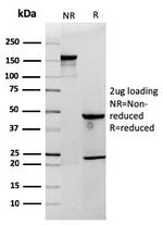 CD3e (T-Cell Marker) Antibody in SDS-PAGE (SDS-PAGE)