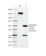 CD3e (T-Cell Marker) Antibody in SDS-PAGE (SDS-PAGE)