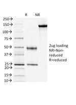 CD3e (T-Cell Marker) Antibody in SDS-PAGE (SDS-PAGE)