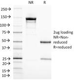 CD3e (T-Cell Marker) Antibody in SDS-PAGE (SDS-PAGE)