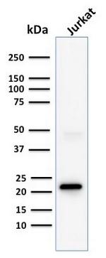 CD3e (T-Cell Marker) Antibody in Western Blot (WB)