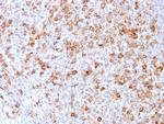 CD3e (T-Cell Marker) Antibody in Immunohistochemistry (Paraffin) (IHC (P))