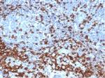CD3e (T-Cell Marker) Recombinant Rabbit Monoclonal Antibody (C3e/4652R)