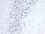 CD3e (T-Cell Marker) Antibody in Immunohistochemistry (Paraffin) (IHC (P))