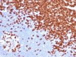 CD3e (T-Cell Marker) Antibody in Immunohistochemistry (Paraffin) (IHC (P))