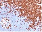 CD3e (T-Cell Marker) Antibody in Immunohistochemistry (Paraffin) (IHC (P))