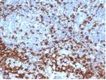 CD3e (T-Cell Marker) Antibody in Immunohistochemistry (Paraffin) (IHC (P))