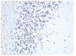 CD3e (T-Cell Marker) Antibody in Immunohistochemistry (Paraffin) (IHC (P))