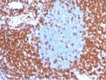 CD3e (T-Cell Marker) Antibody in Immunohistochemistry (Paraffin) (IHC (P))