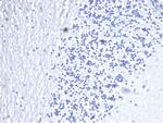 CD3e (T-Cell Marker) Antibody in Immunohistochemistry (Paraffin) (IHC (P))