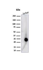 CD3e (T-Cell Marker) Antibody in Western Blot (WB)