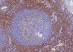 CD3e (T-Cell Marker) Antibody in Immunohistochemistry (Paraffin) (IHC (P))