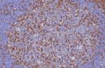 CD3e (T-Cell Marker) Antibody in Immunohistochemistry (Paraffin) (IHC (P))