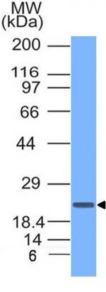 CD3e (T-Cell Marker) Antibody in Western Blot (WB)