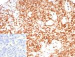 CD3G/CD3beta1/TCR beta Antibody in Immunohistochemistry (Paraffin) (IHC (P))