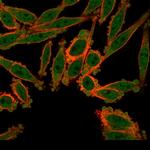 ZBED1/DREF Antibody in Immunocytochemistry (ICC/IF)