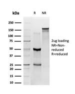 ZBED1/DREF Antibody in SDS-PAGE (SDS-PAGE)