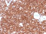 CD4 Antibody in Immunohistochemistry (Paraffin) (IHC (P))