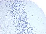 CD4 Antibody in Immunohistochemistry (Paraffin) (IHC (P))