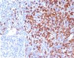 CD4 (T-Helper/Inducer Cell Marker) Antibody in Immunohistochemistry (Paraffin) (IHC (P))