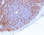 CD4 (T-Helper/Inducer Cell Marker) Antibody in Immunohistochemistry (Paraffin) (IHC (P))