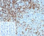 CD4 (T-Helper/Inducer Cell Marker) Antibody in Immunohistochemistry (Paraffin) (IHC (P))