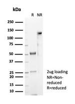 CD4 (T-Helper/Inducer Cell Marker) Antibody in SDS-PAGE (SDS-PAGE)