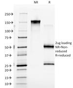 CD4 (T-Helper/Inducer Cell Marker) Antibody in SDS-PAGE (SDS-PAGE)