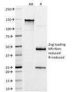 CD4 (T-Helper/Inducer Cell Marker) Antibody in SDS-PAGE (SDS-PAGE)