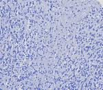 CD4 (T-Helper/Inducer Cell Marker) Antibody in Immunohistochemistry (Paraffin) (IHC (P))
