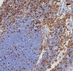 CD4 (T-Helper/Inducer Cell Marker) Antibody in Immunohistochemistry (Paraffin) (IHC (P))