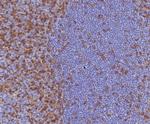CD4 (T-Helper/Inducer Cell Marker) Antibody in Immunohistochemistry (Paraffin) (IHC (P))