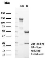 CD4 (T-Helper/Inducer Cell Marker) Antibody in SDS-PAGE (SDS-PAGE)