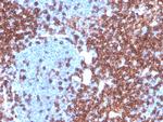 CD4 Antibody in Immunohistochemistry (Paraffin) (IHC (P))
