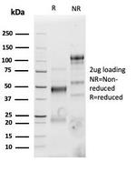 CD4 Antibody in SDS-PAGE (SDS-PAGE)