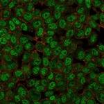 ZMYM3 Monoclonal Antibody (PCRP-ZMYM3-2F10)