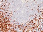 CD5 (Mantle Cell Lymphoma Marker) Antibody in Immunohistochemistry (Paraffin) (IHC (P))