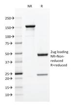 CD5 (Mantle Cell Lymphoma Marker) Antibody in SDS-PAGE (SDS-PAGE)