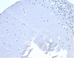 CD5 (Mantle Cell Lymphoma Marker) Antibody in Immunohistochemistry (Paraffin) (IHC (P))