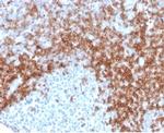 CD5 (Mantle Cell Lymphoma Marker) Antibody in Immunohistochemistry (Paraffin) (IHC (P))