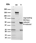 CD5 (Mantle Cell Lymphoma Marker) Antibody in SDS-PAGE (SDS-PAGE)