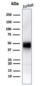 CD5 (Mantle Cell Lymphoma Marker) Antibody in Western Blot (WB)