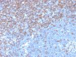 CD5 (Mantle Cell Lymphoma Marker) Antibody in Immunohistochemistry (Paraffin) (IHC (P))