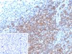 CD5 (Mantle Cell Lymphoma Marker) Antibody in Immunohistochemistry (Paraffin) (IHC (P))