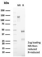 CD5 (Mantle Cell Lymphoma Marker) Antibody in SDS-PAGE (SDS-PAGE)
