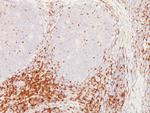 CD5 (Mantle Cell Lymphoma Marker) Antibody in Immunohistochemistry (Paraffin) (IHC (P))