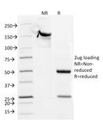 CD5 (Mantle Cell Lymphoma Marker) Antibody in SDS-PAGE (SDS-PAGE)