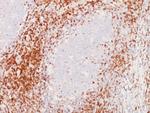 CD5 (Mantle Cell Lymphoma Marker) Antibody in Immunohistochemistry (Paraffin) (IHC (P))