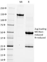 CD5 (Mantle Cell Lymphoma Marker) Antibody in SDS-PAGE (SDS-PAGE)