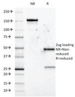 CD5 (Mantle Cell Lymphoma Marker) Monoclonal Antibody (B-B8)